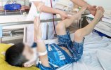 Bệnh lý Hemophilia thường di truyền cho con trai
